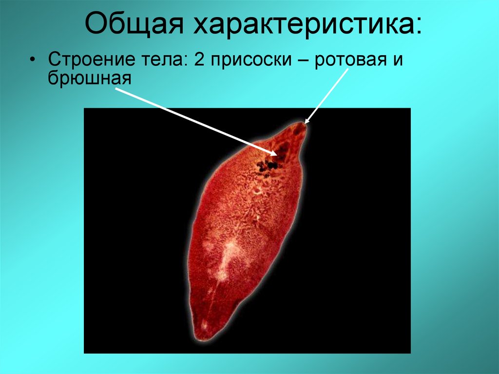 Образ жизни сосальщиков. Черви-сосальщики – трематоды.. Представители сосальщики плоские черви. Плоские черви печеночные сосальщики. Паразитические черви печеночный сосальщик.