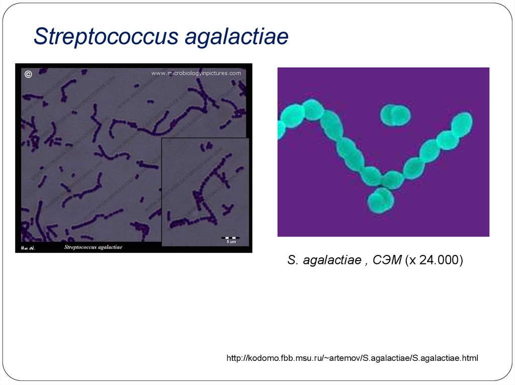 Streptococcus agalactiae у мужчин. Стрептококк агалактия. Стрептококки морфология.