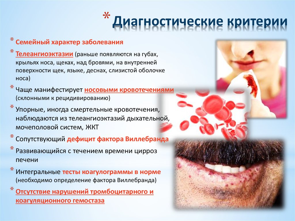 Диагностические критерии