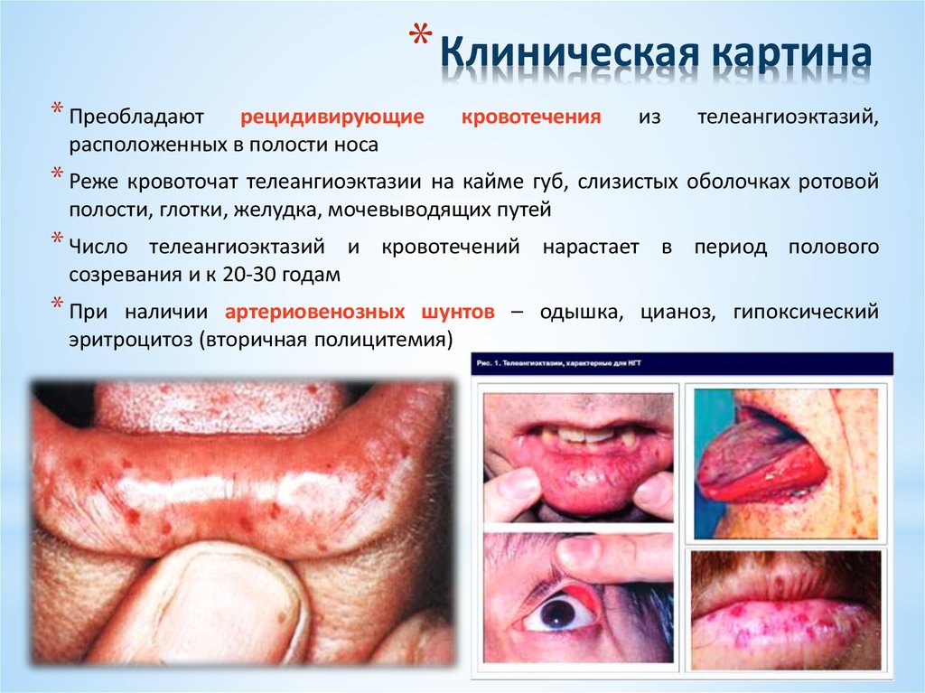 Клиническая картина