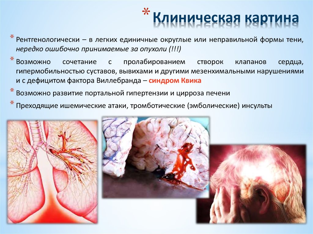 Клиническая картина