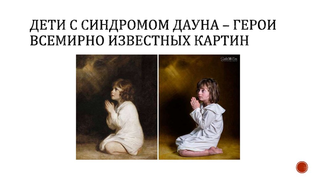 Дети с синдромом ДАУНА – ГЕРОИ ВСЕМИРНО ИЗВЕСТНЫХ КАРТИН