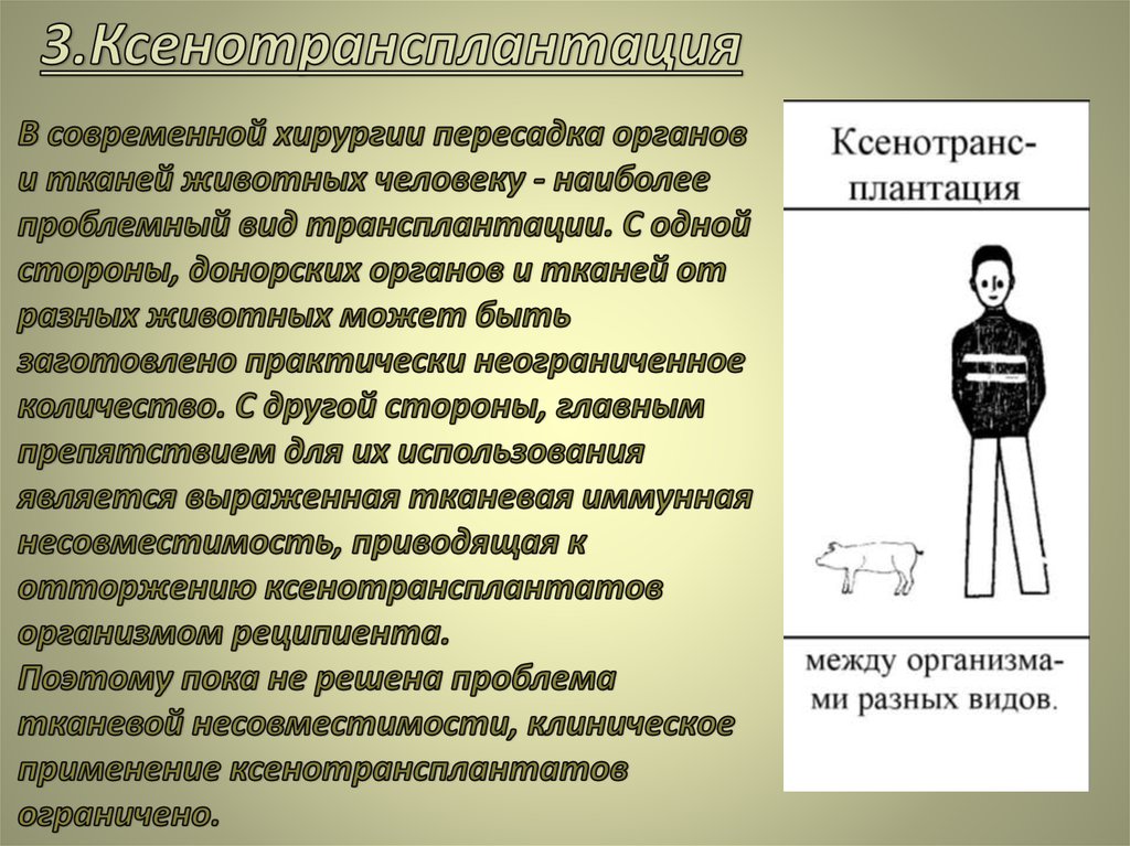 Какие органы преображенский пересадил. Ксенотрансплантация виды. Проблемы современной хирургии. Ксенотрансплантация презентация. Проблемы ксенотрансплантации.