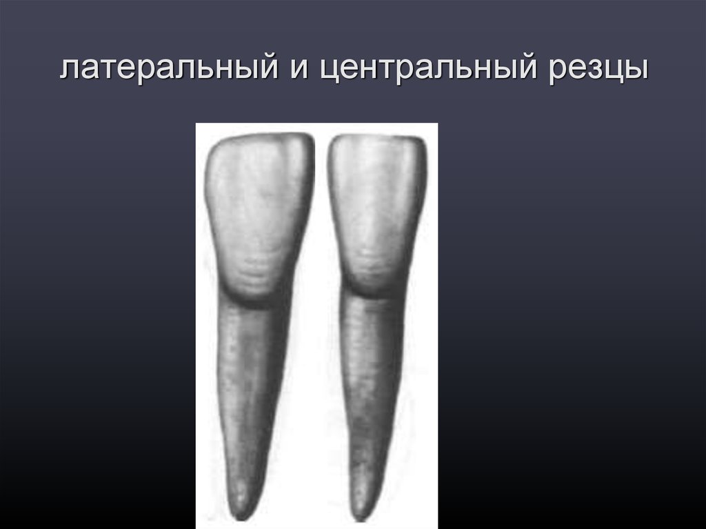 Центральных резцов. Латеральный резец нижней челюсти. Нижний медиальный резец анатомия. Медиальный и латеральные нижние резцы..