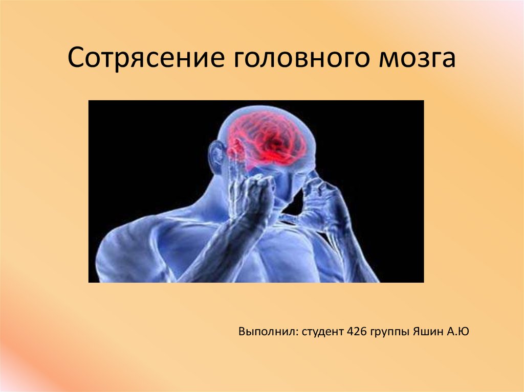Синдромы сотрясения. Сотрясение головного мозга. Сотрясение головного м. Сотрясени еголовоного мозга. Сотрясение головного мозга презентация.
