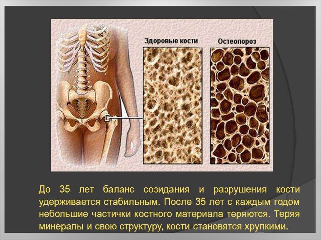 Здорова костя