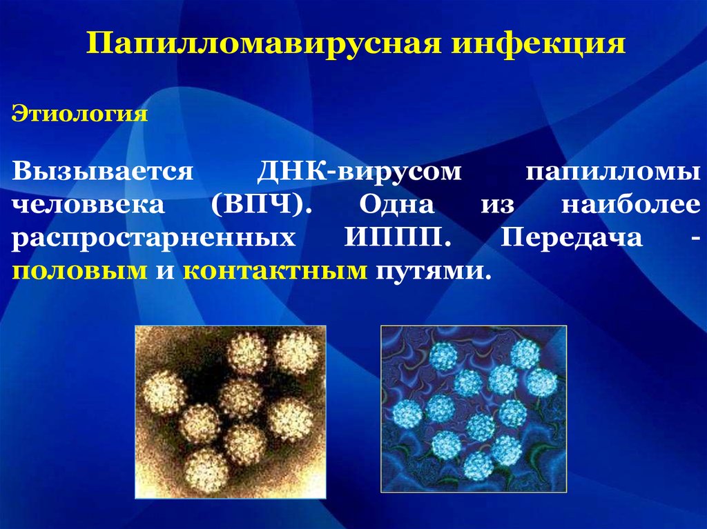 Впч что это. Возбудители папилломавирусной инфекции. Этиология папилломавирусной инфекции. Папилломавирусная инфекция вызывается. Папиломо-вирусной инфекции это.