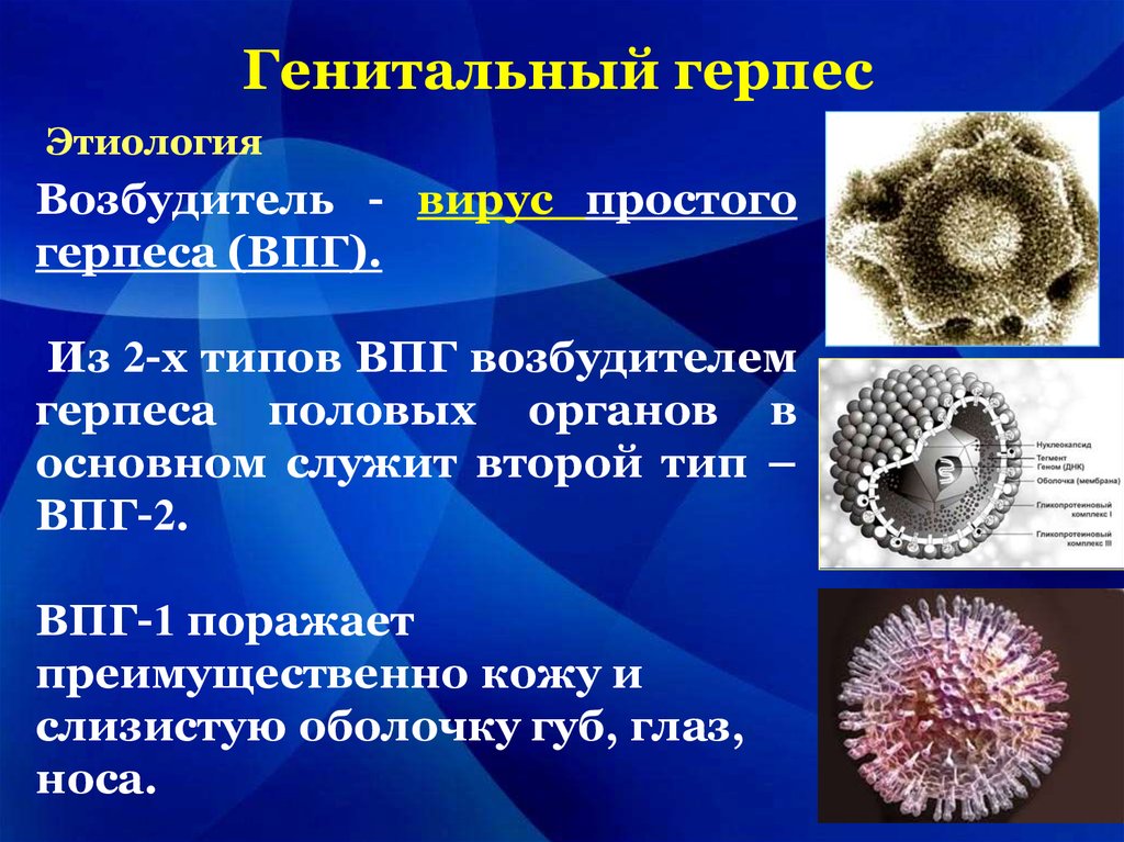 Типы вируса герпеса. Этиология вируса простого герпеса 2 типа. Вирус герпеса 1 типа этиология. Генитальный герпес возбудитель инфекции. Вирус простого герпеса 1 типа этиология.