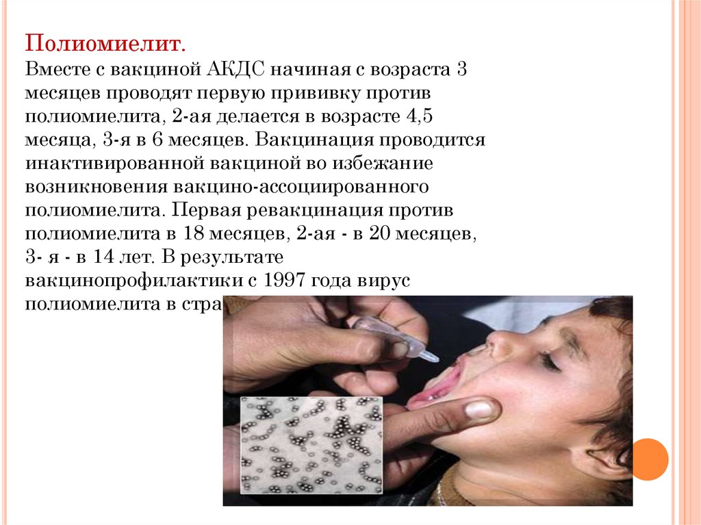 Введение полиомиелитной вакцины
