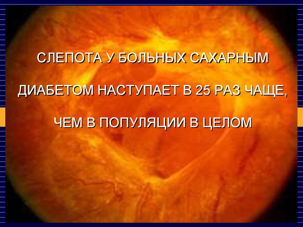 Сахарная слепота. Слепота при сахарном диабете. Причины слепоты при сахарном диабете. Презентация диабетический макулярный отёк. Слепота у больного сахарным диабетом.