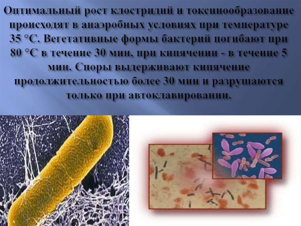 Бактерии гибнут от. Вегетативные формы микроорганизмов это. Клостридии форма бактерии.