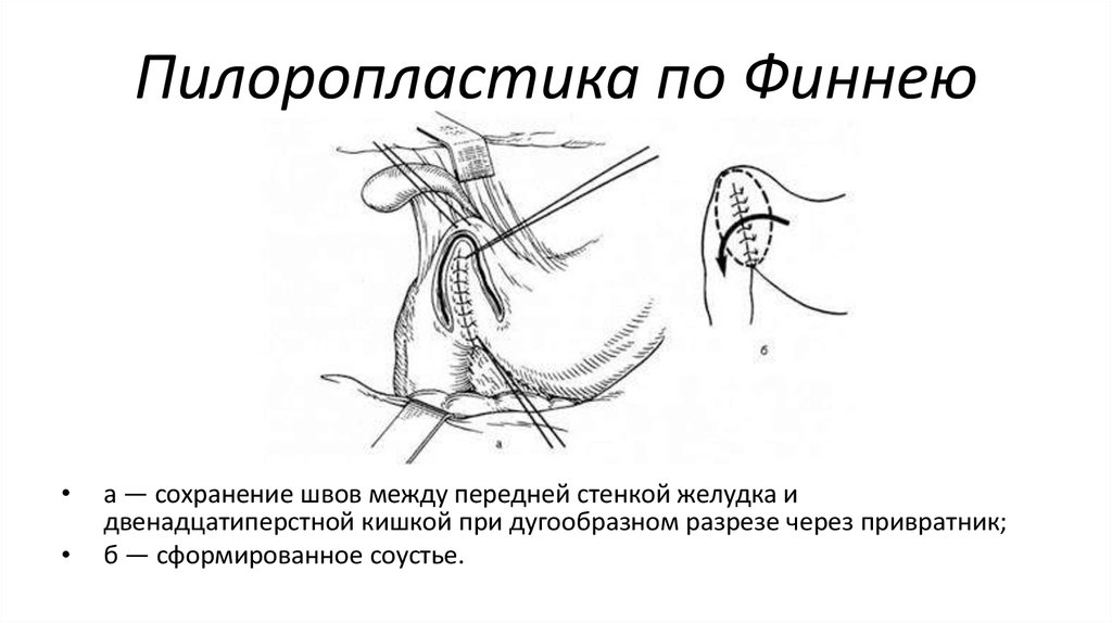 Бвк 322 схема подключения