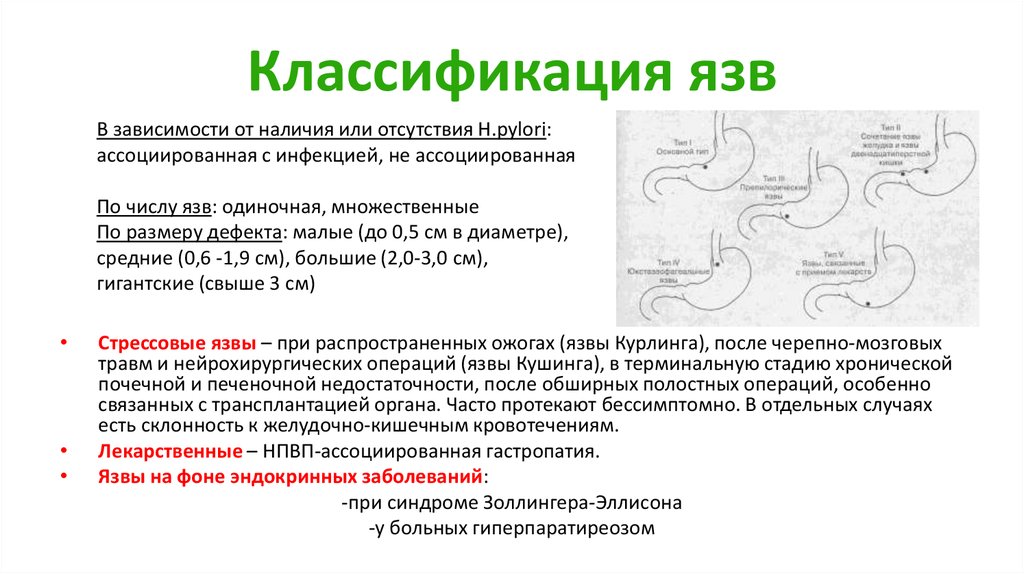 Классификация язвенной болезни желудка