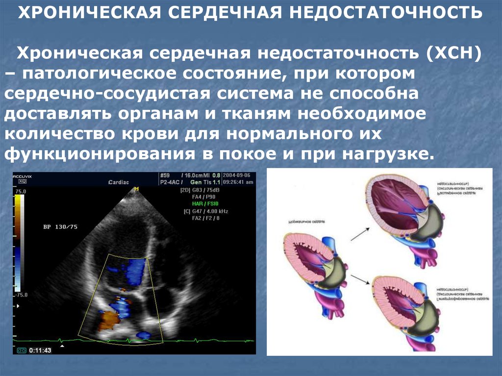 Презентация на тему хсн