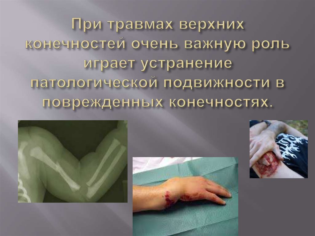 Особенности интенсивной терапии и анестезии при травме верхних ...