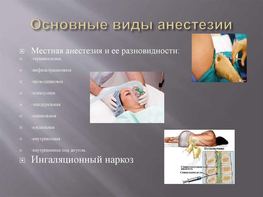 Основные виды анестезии