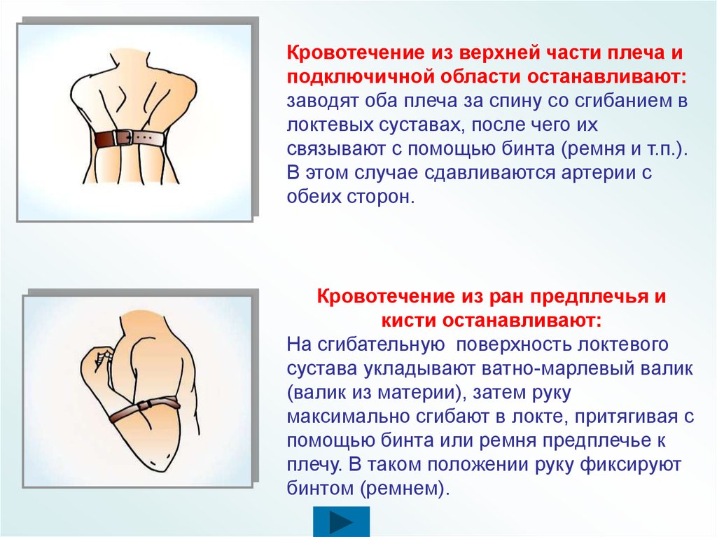 Открытая рана предплечья карта вызова