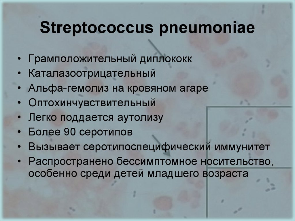 Стрептококки у женщин лечение. Streptococcus pneumoniae (пневмококк). Стрептококк пневмонии группа. Streptococcus pneumoniae симптомы. Стрептококк пневмония морфология.