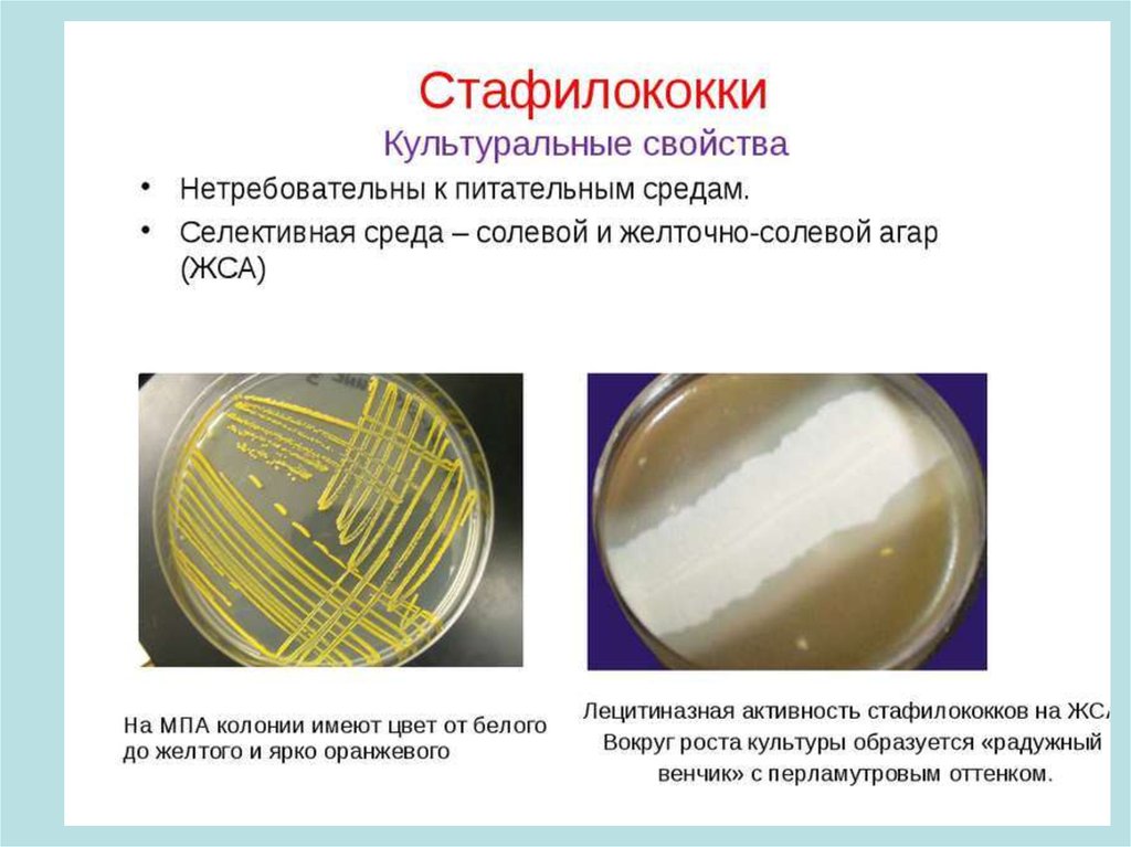 Staphylococcus aureus среда. Радужный венчик стафилококка на ЖСА. Питательная среда желточно солевой агар. ЖСА питательная среда. Элективная питательная среда, ЖСА.