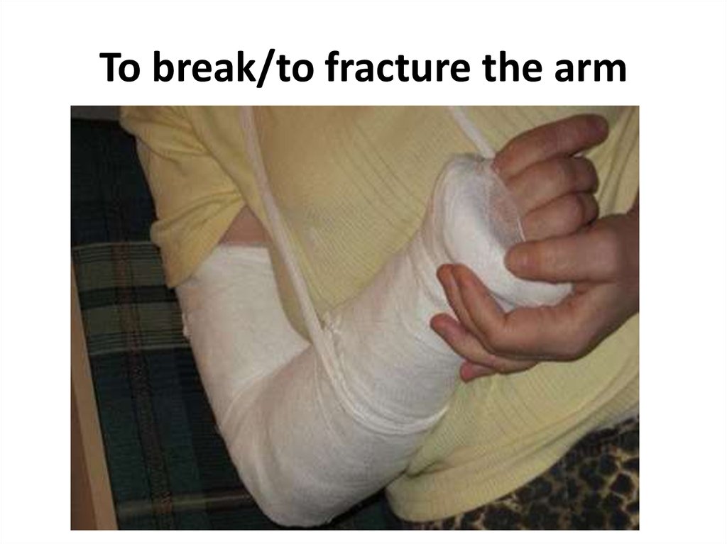 To break/to fracture the arm
