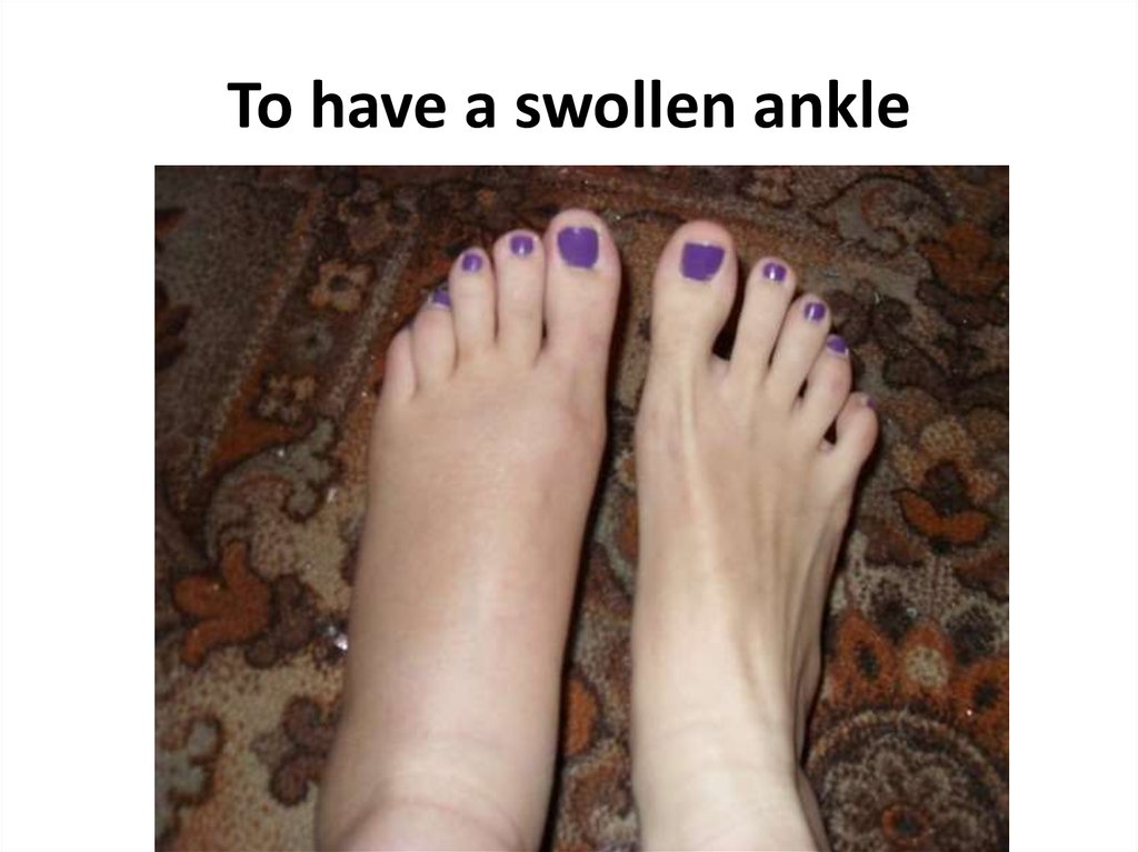 To have a swollen ankle