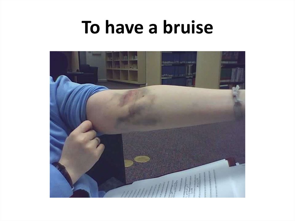 To have a bruise
