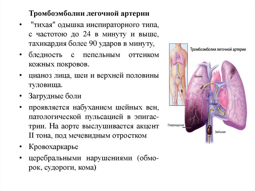 Легочная тромбоэмболия прогноз. Тромбоэмболия легочной артерии. Тромбоэмболия легочной артерии описание. Тромбоэболиялегосной артерии.