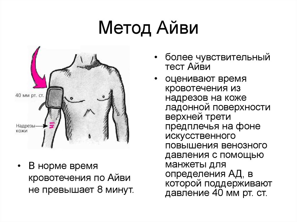 Длительность кровотечения. Длительность кровотечения по Айви. Методика кровотечения по Дюку. Метод Айви кровотечение. Метод Айви время кровотечения.