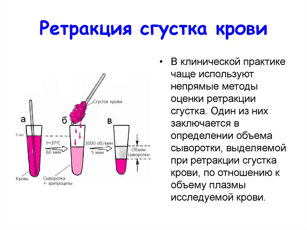 Ретракция. Ретракция кровяного сгустка физиология. Ретракция кровяного сгустка биохимия. Ретракция тромбоцитарного сгустка. Ретракция кровяного сгустка определяется функцией.