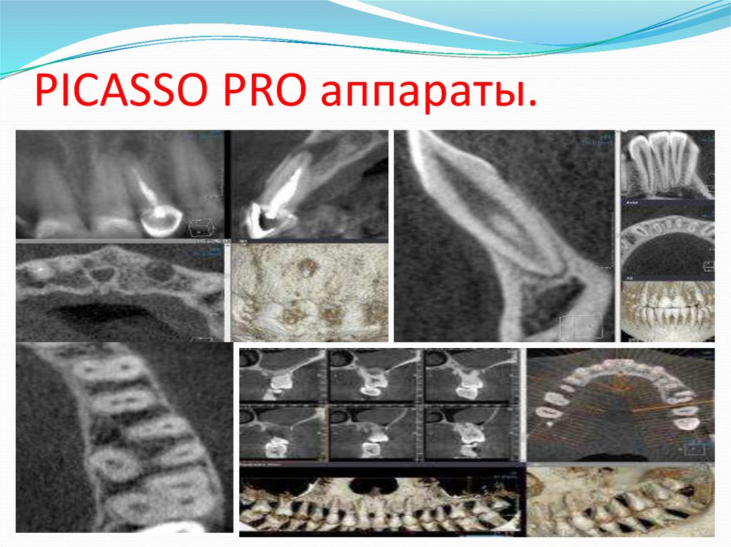 PICASSO PRO аппараты.