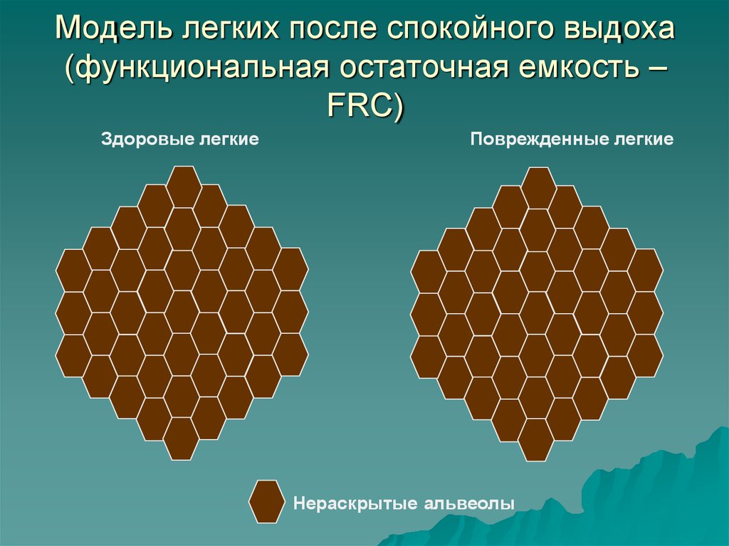 Мод легкие. Модель easier презентация.