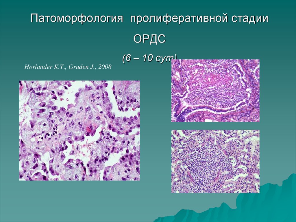 Патоморфологическая картина это