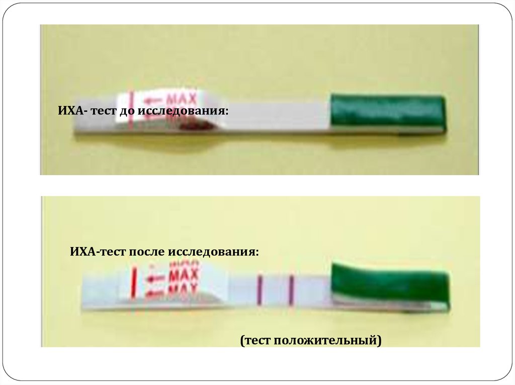 Качественно иммунохроматографический тест. ИХА тест. Тест-полоски ИХА. ИХА-исследования,. Иммунохроматографические экспресс-тесты.