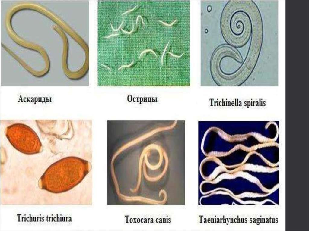 Аскаридоз презентация казакша