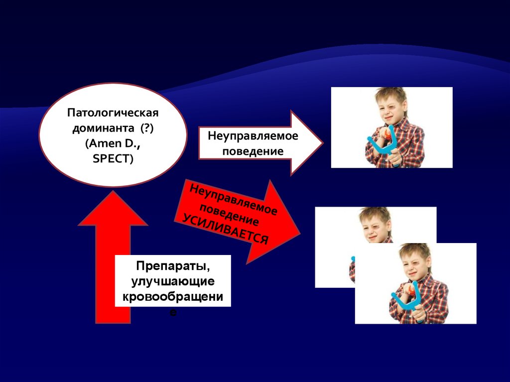 Синдром дефицита внимания презентация