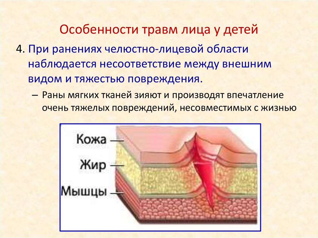 Мягкие ткани кожи. Повреждения мягких тканей лица у детей. Ранения мягких тканей лица. Травмы мягких тканей лица.