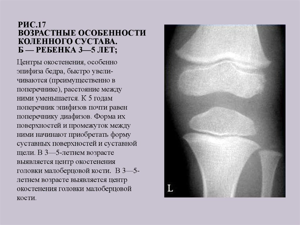 Сустав норма. Коленный сустав у детей рентген норма. Коленный сустав ребенка рентген. Рентген анатомия коленного сустава у детей. Ядра окостенения коленного сустава рентген.