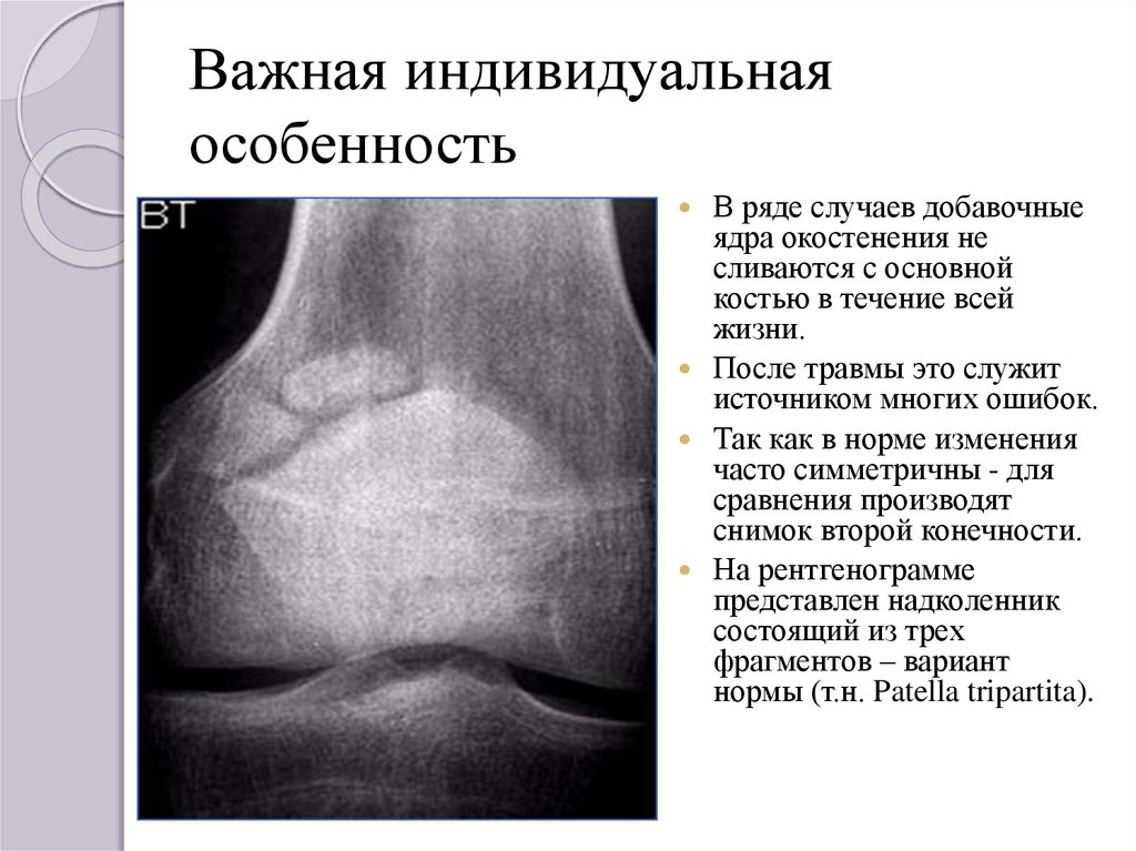 Перелом надколенника карта вызова