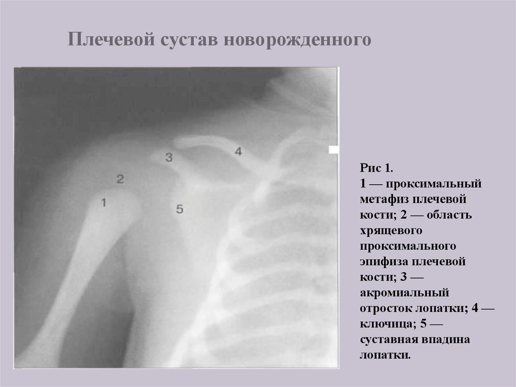 Ключица это плечо