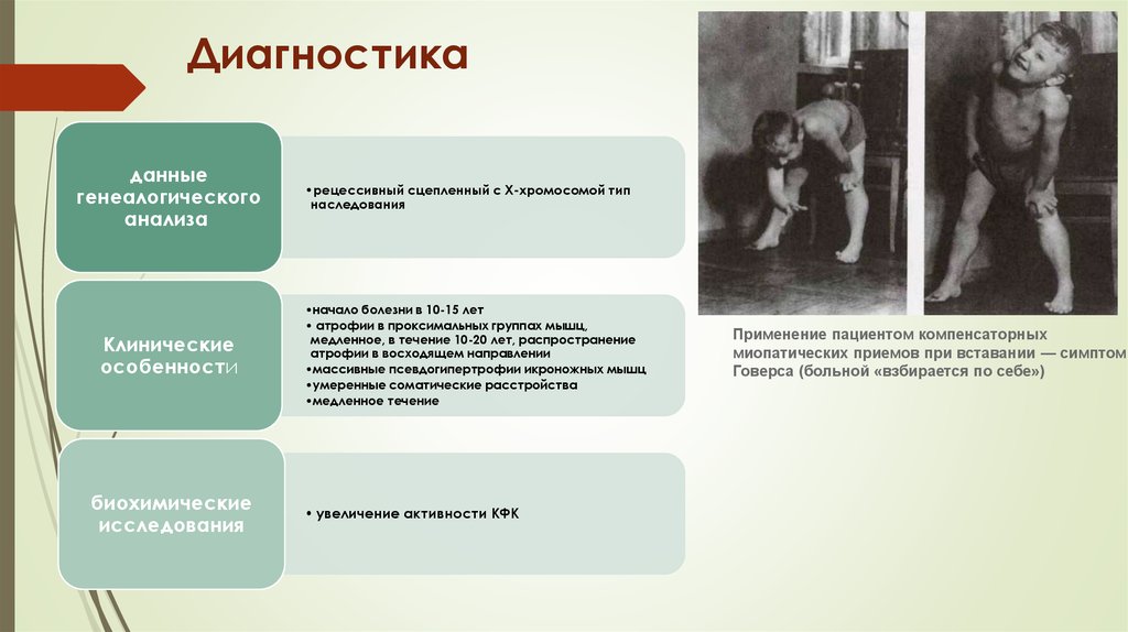 Прогрессирующие мышечные дистрофии. Х – сцепленные рецессивные заболевания, их клинические проявления. Заболевания сцепленные с х хромосомой. Рецессивные сцепленные с х хромосомой заболевания характеристика. Прогрессирующие мышечные дистрофии неврология.