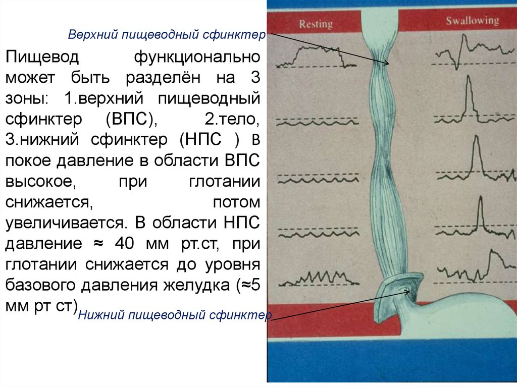 Закрытие сфинктера. Верхний пищеводный сфинктер. Верхний и Нижний пищеводные сфинктеры. Верхний сфинктер пищевода. Нижний пищеводный сфинктер.