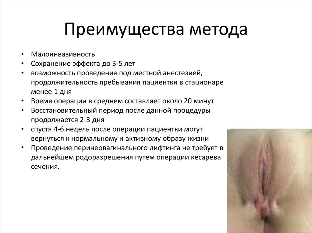 Преимущества метода