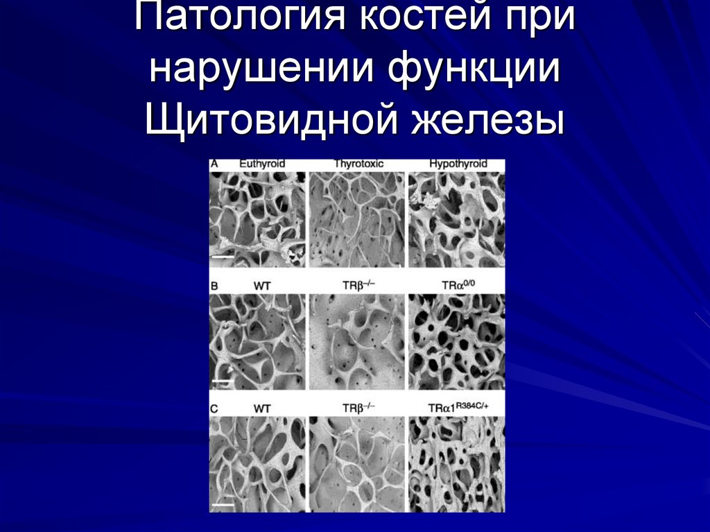 5 патологий. Аномалии костной ткани. Синдромы патологии костей.