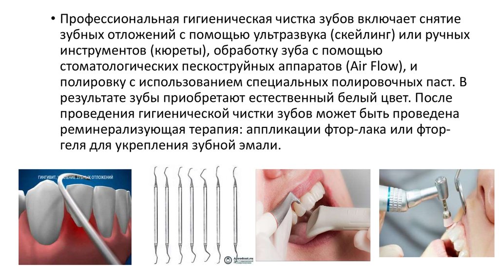 Методы удаления зубных отложений презентация