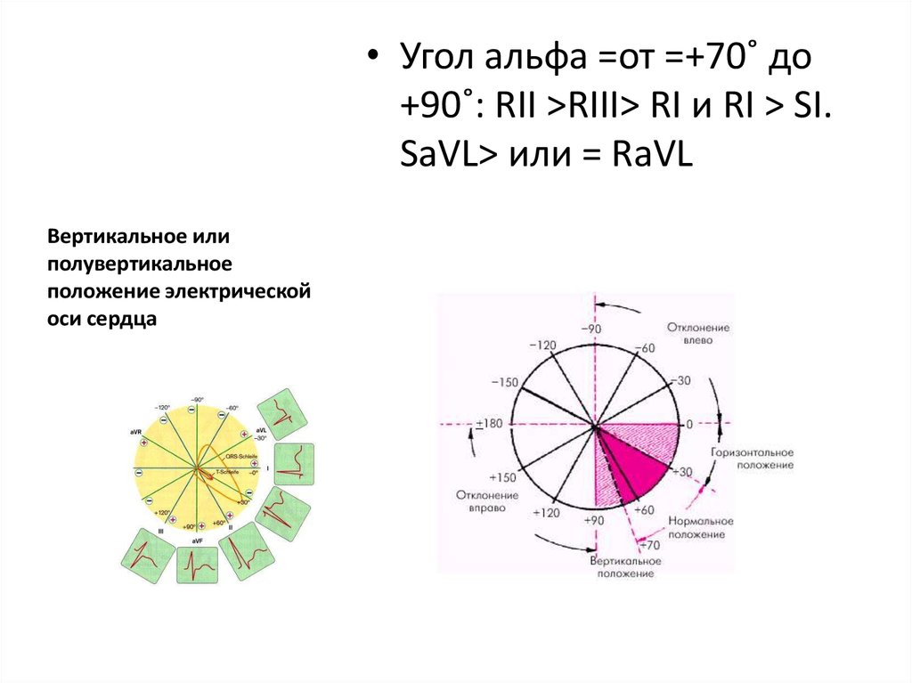 Что значит вертикальная ось. Электрическая ось сердца на ЭКГ угол Альфа. Положение ЭОС угол Альфа. Электрическая ось угол Альфа. Угол Альфа 90 градусов ЭКГ.
