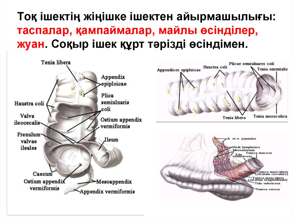 Ішек анатомиясы презентация