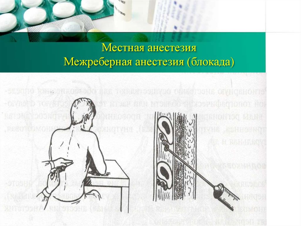 Что значит местная анестезия