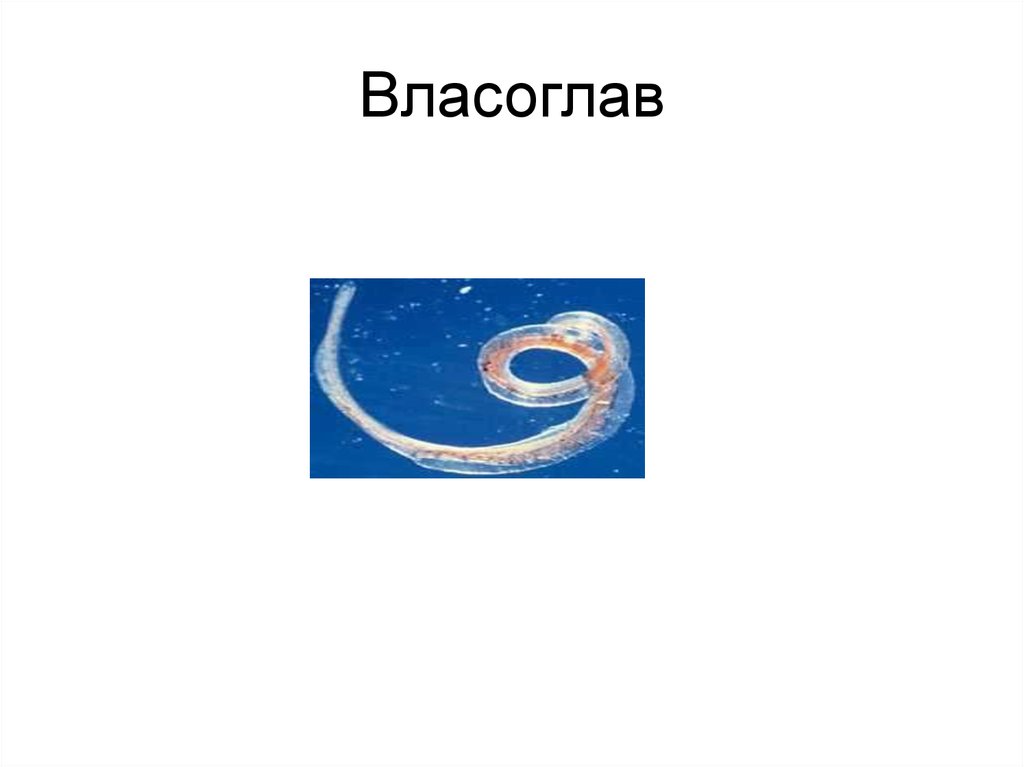 Власоглав. Власоглав презентация. Власоглав строение. Аскаридоз презентация.