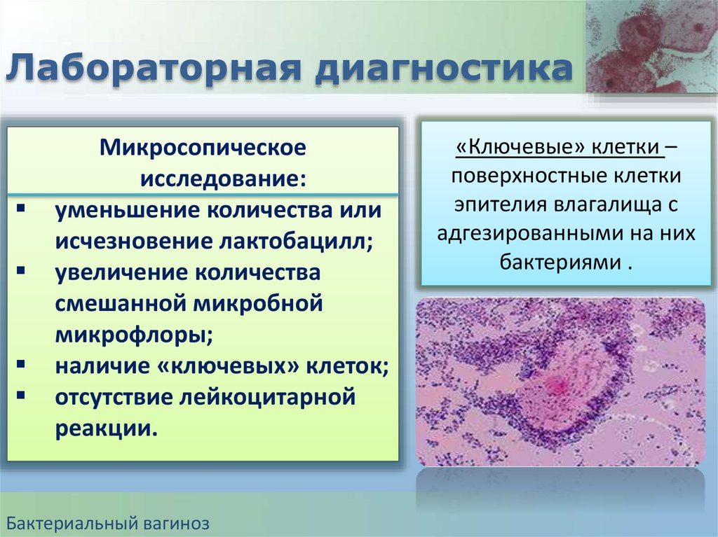 Баквагиноз что это. Бактериальный вагиноз лабораторная диагностика. Диагноз бактериальный вагиноз. Бактериальные заболевания к гинекологии.