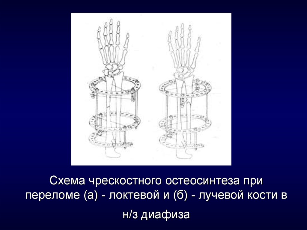 Схема центра илизарова